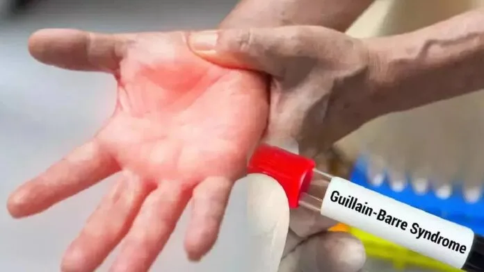 Guillain-Barre Syndrome cases